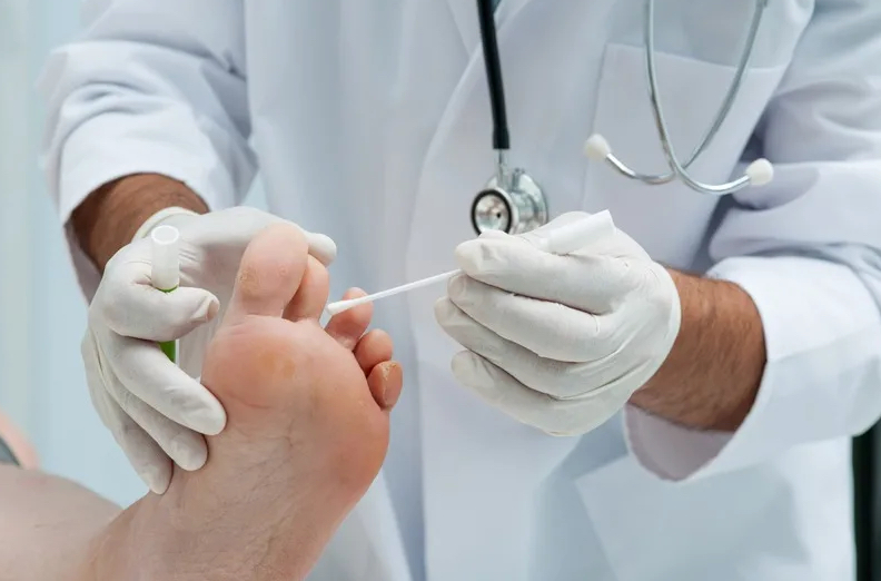 Чем опасен грибок ногтей? Причины появления, лечение и профилактика грибка ногтей на ногах здоровье, Здоровье