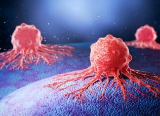 Smantellare l’armatura del cancro al pancreas